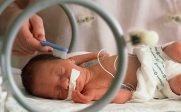 وحدة الاطفال المنسترين – مجهزة بأحدث اجهزة التنفس الصناعى